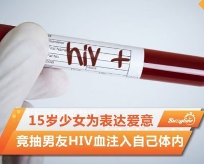 Hiv