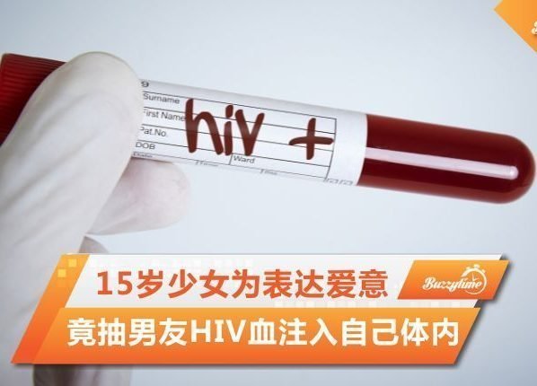 Hiv